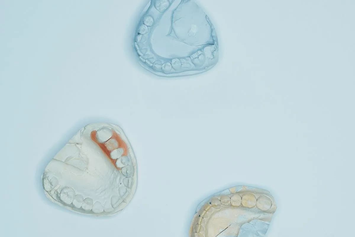What Is an Orthodontic Appliance (Palatal Expander) Used For?