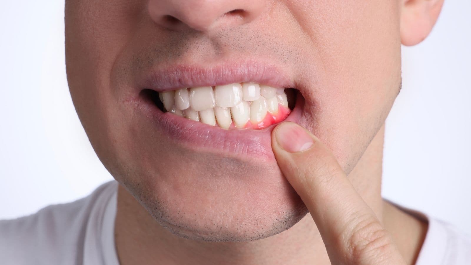 Periodontoloji