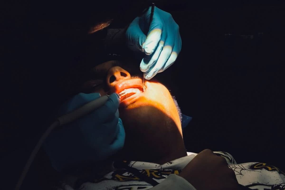 Root Planing (Curettage) Treatment Prices in Samsun 2026