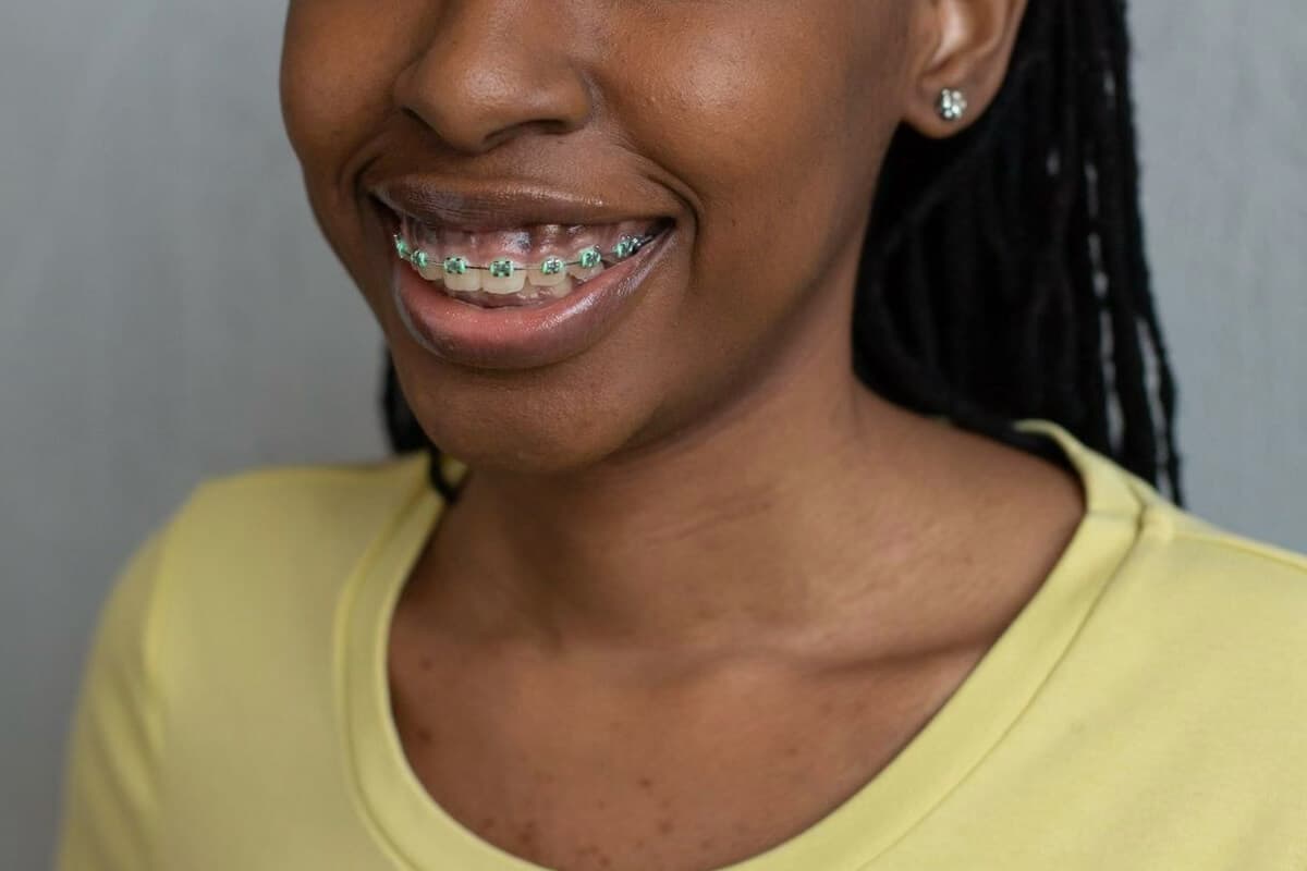Health Benefits of Orthodontic Treatment