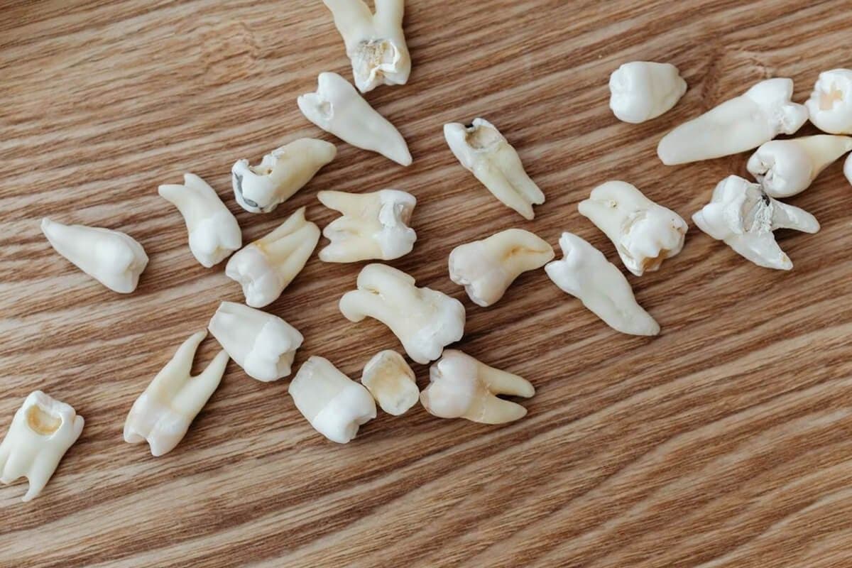 Samsun Endodonti (Kanal Tedavisi)