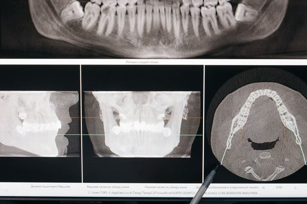 Steps of the Orthodontic Treatment Process