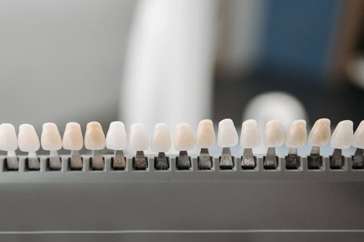 Care and Protection After Veneers