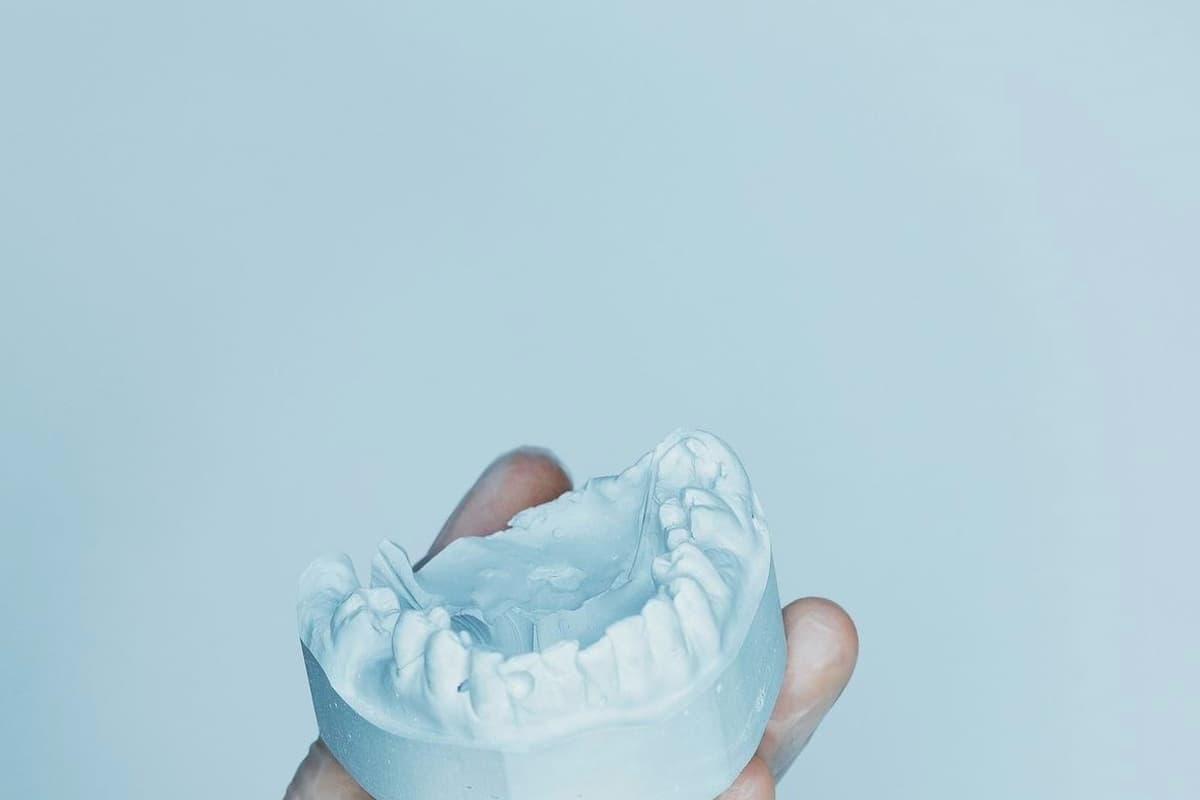 Step-by-Step Prosthodontic Dental Treatment Process