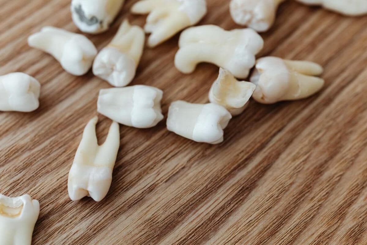 What Is Root Canal Retreatment?
