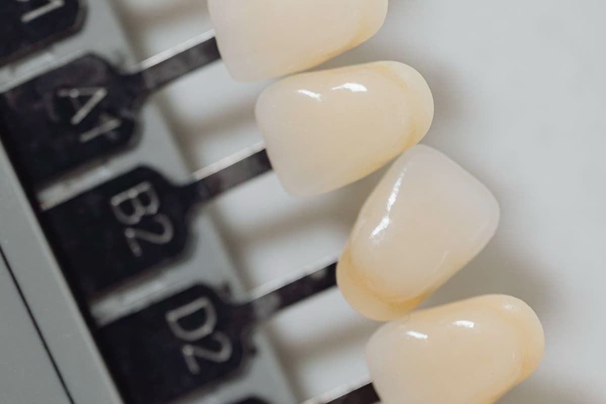 Advantages of Zirconia Crowns