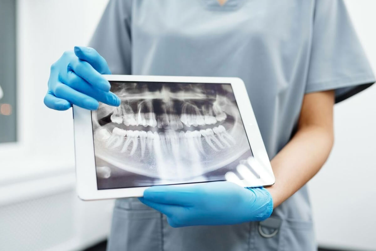 Endodonti Tedavisinin Etkinliği ve Başarı Oranları