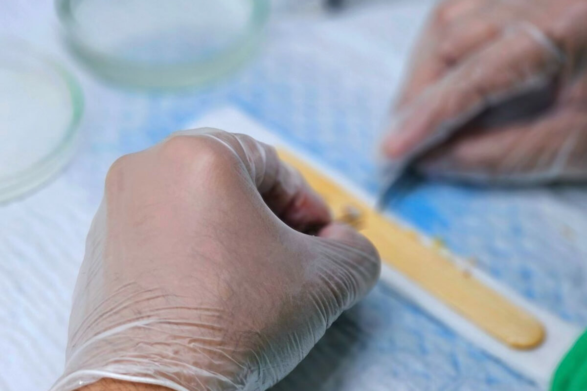 Kemik Tozu Ekleme ve Kaynama Süreci
