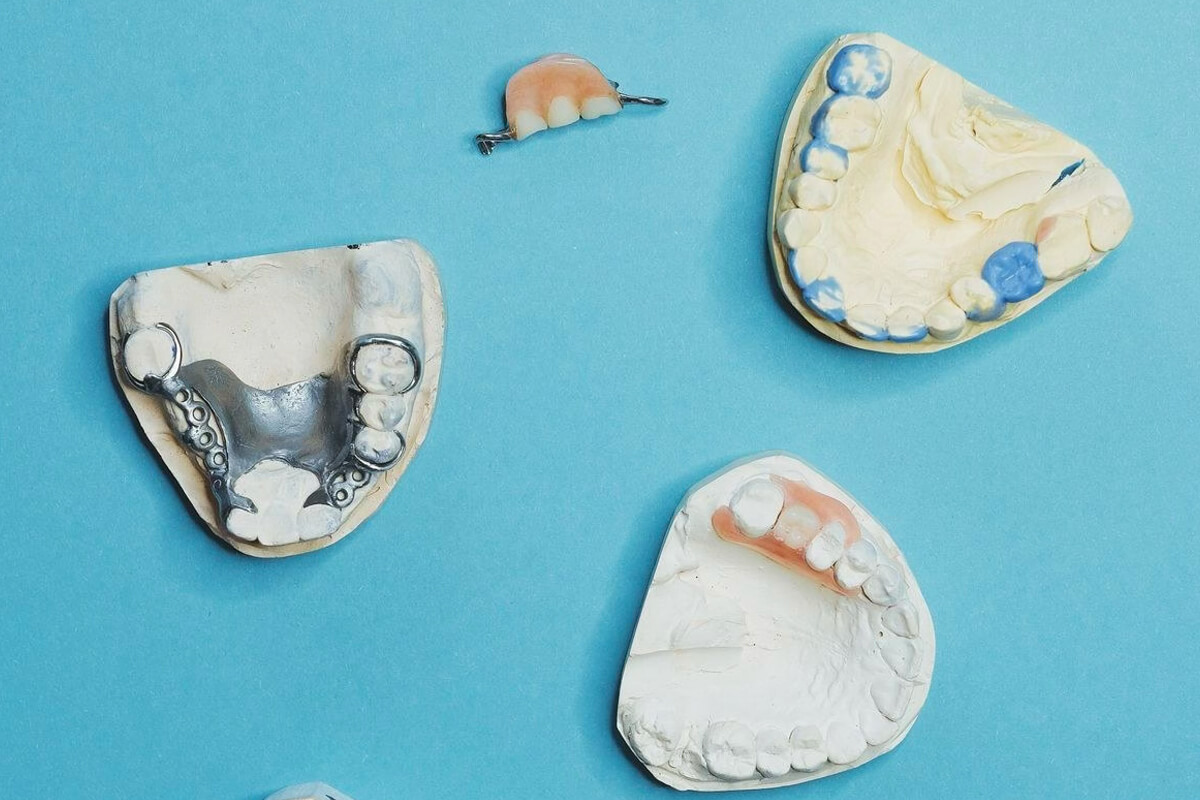 Porselen Kaplama ile Zirkonyum Kaplama Karşılaştırması