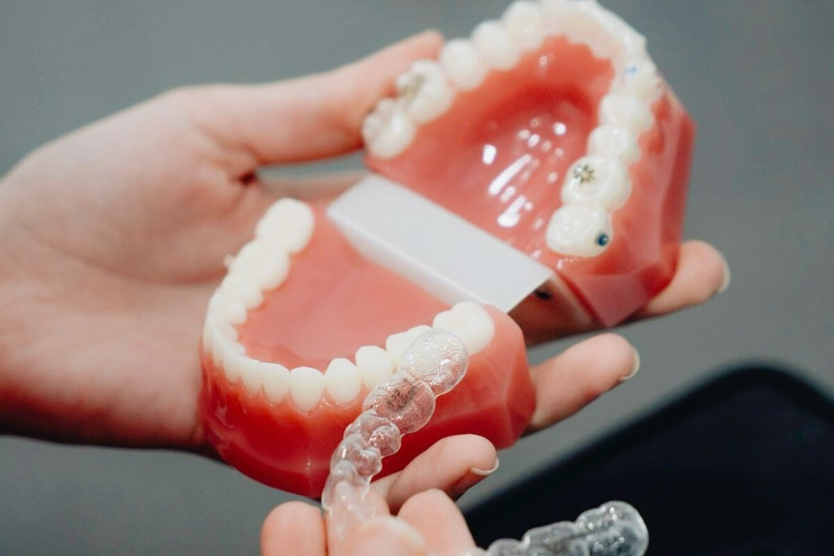 Retainer Uygulaması